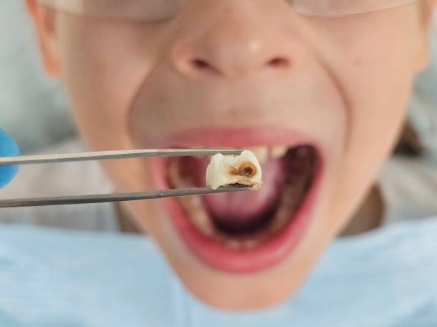 Best Emergency Dental Care for Trauma or Injury in Holland, MI